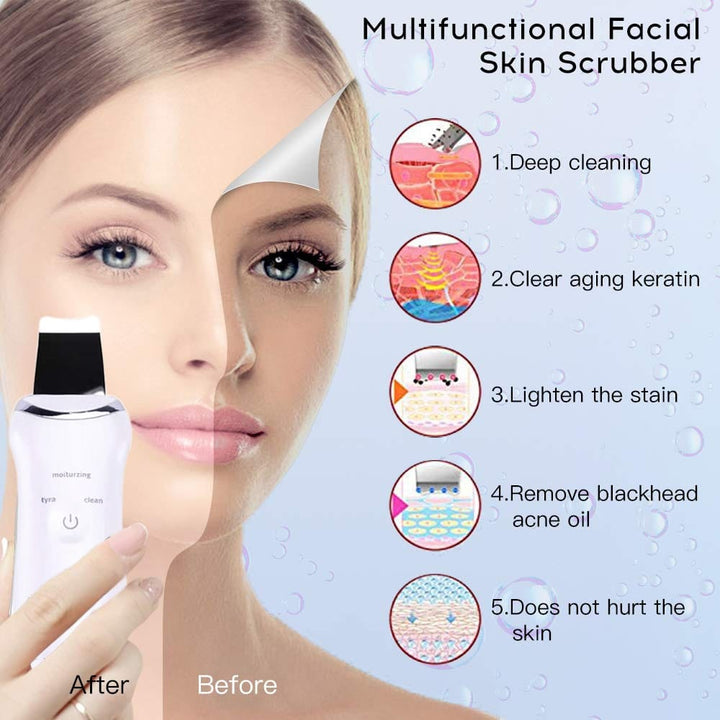 Aayat Mart 0 Ultrasonic Blue Light Face Deep Cleaning Skin Scrubber Remove Dirt Blackhead Reduce Wrinkles spots Facial Skin Whitening Lifting